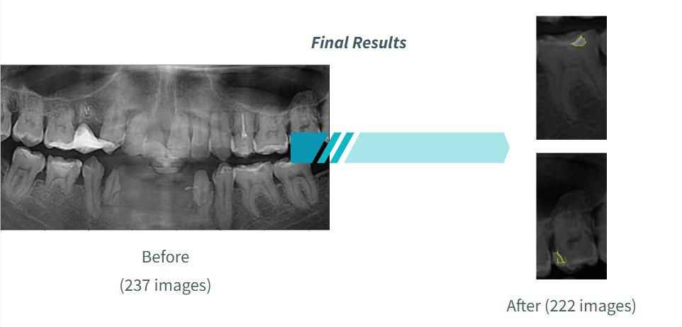 Segmentation Results